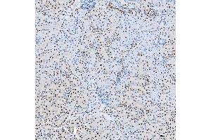 IHC analysis of SF3B3 using anti-SF3B3 antibody (ABIN7602378).