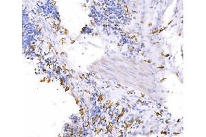 IHC analysis of SH3GL2 using anti-SH3GL2 antibody (ABIN7602229). (SH3G2 Antikörper  (AA 65-292))