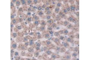 Used in DAB staining on fromalin fixed paraffin- embedded Kidney tissue (CD109 Antikörper  (AA 719-965))