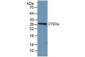 Detection of Recombinant PCK1, Mouse using Polyclonal Antibody to Phosphoenolpyruvate Carboxykinase 1, Soluble (PCK1) (PCK1 Antikörper  (AA 312-563))