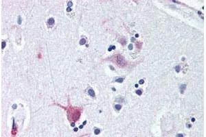 Immunohistochemical staining of human brain, cortex with WNT8B polyclonal antibody . (WNT8B Antikörper  (C-Term))