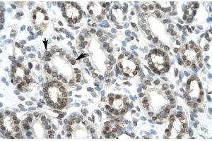 Rabbit Anti-HEY1 Antibody ,Paraffin Embedded Tissue: Human Kidney  Cellular Data: Epithelial cells of renal tubule  Antibody Concentration: 4. (HEY1 Antikörper  (C-Term))