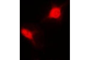 Immunofluorescent analysis of Sm-D2 staining in MCF7 cells. (SNRPD2 Antikörper)