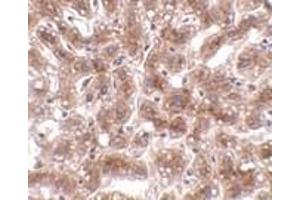 Immunohistochemistry of CUEDC1 in human liver tissue with CUEDC1 antibody at 2 μg/ml. (CUEDC1 Antikörper  (C-Term))