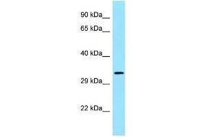 WB Suggested Anti-FGFR1OP2 Antibody Titration: 1. (FGFR1OP2 Antikörper  (C-Term))