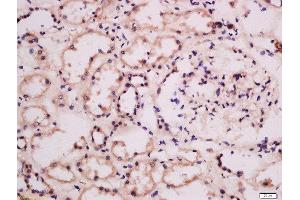 Formalin-fixed and paraffin embedded human kidney labeled with Anti-GRB10/14 Polyclonal Antibody, Unconjugated  at 1:100 followed by conjugation to the secondary antibody and DAB staining. (GRB10/14 (AA 501-594) Antikörper)