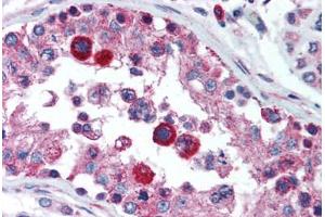 Human Testis (formalin-fixed, paraffin-embedded) stained with HAVCR1 antibody ABIN292373 at 5 ug/ml followed by biotinylated goat anti-rabbit IgG secondary antibody ABIN481713, alkaline phosphatase-streptavidin and chromogen. (HAVCR1 Antikörper  (N-Term))