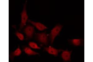 ABIN6267617 staining NIH-3T3 by IF/ICC. (PKC delta Antikörper  (pSer645))