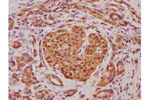 Immunohistochemistry (IHC) image for anti-ATP-Binding Cassette, Sub-Family D (Ald), Member 4 (ABCD4) (AA 335-606) antibody (ABIN7144920)