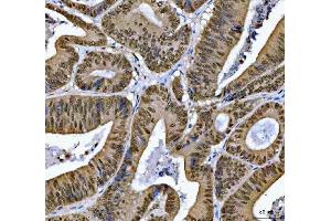 IHC analysis of SNRPN using anti-SNRPN antibody (ABIN3043934). (SNRPN Antikörper  (N-Term))