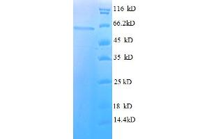 SDS-PAGE (SDS) image for Histone Deacetylase 3 (HDAC3) (AA 1-428), (full length) protein (His-SUMO Tag) (ABIN5709651)