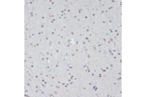 Immunohistochemistry of paraffin-embedded mouse brain using Phospho-CDK1-Y15 antibody (ABIN3019442, ABIN3019443, ABIN3019444 and ABIN6225371) at dilution of 1:100 (40x lens). (CDK1 Antikörper  (pTyr15))