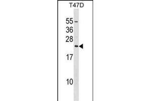 Western Blotting (WB) image for anti-Eukaryotic Translation Initiation Factor 3 Subunit K (EIF3K) (AA 176-204), (C-Term) antibody (ABIN1536791)