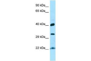 WB Suggested Anti-KTI12 Antibody Titration: 1. (KTI12 Antikörper  (C-Term))