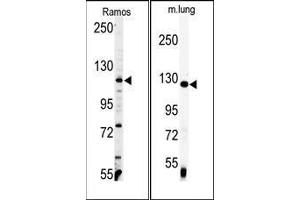 (LEFT) Western blot analysis of anti-VINC Antibody (C-term) in Ramos cell line lysates (35ug/lane). (Vinculin Antikörper  (C-Term))