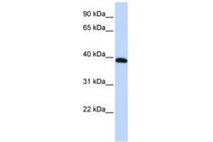 Image no. 1 for anti-Homeobox A10 (HOXA10) (AA 288-337) antibody (ABIN6744392) (HOXA10 Antikörper  (AA 288-337))