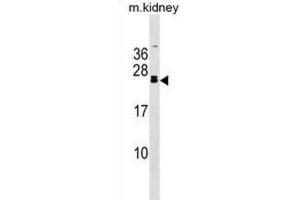 Western Blotting (WB) image for anti-Fibroblast Growth Factor 20 (FGF20) antibody (ABIN3000853) (FGF20 Antikörper)