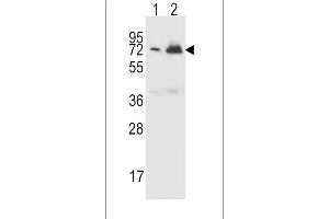 CFHR5 Antibody (Center) (ABIN651876 and ABIN2840434) western blot analysis in CEM(lane 1),K562(lane 2) cell line lysates (15 μg/lane). (CFHR5 Antikörper  (AA 203-231))