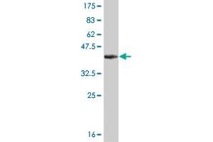 Western Blot detection against Immunogen (36. (KAT2B Antikörper  (AA 353-452))