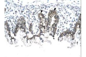 Image no. 1 for anti-Prohibitin (PHB) (AA 203-252) antibody (ABIN6735810) (Prohibitin Antikörper  (AA 203-252))