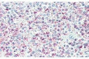 Detection of TNFaIP6 in Human Spleen Tissue using Polyclonal Antibody to Tumor Necrosis Factor Alpha Induced Protein 6 (TNFaIP6) (TNFAIP6 Antikörper  (AA 18-275))