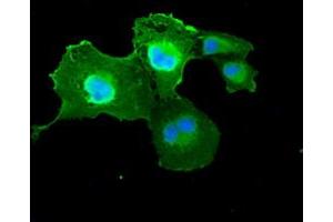 Anti-DFFA mouse monoclonal antibody (ABIN2452370) immunofluorescent staining of COS7 cells transiently transfected by pCMV6-ENTRY DFFA (RC202879). (DFFA Antikörper)