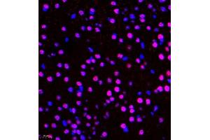 Immunofluorescence of paraffin embedded mouse brain using ZNF106 (ABIN7076260) at dilution of 1:500 (400x lens) (ZFP106 Antikörper)