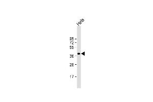 Anti-ARPC1B Antibody (Center) at 1:1000 dilution + Hela whole cell lysate Lysates/proteins at 20 μg per lane. (ARPC1B Antikörper  (AA 159-188))