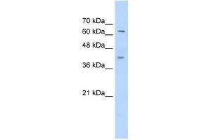 Western Blot showing ZNF415 antibody used at a concentration of 1-2 ug/ml to detect its target protein.