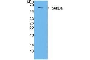 Detection of Recombinant TMEM27, Mouse using Polyclonal Antibody to Transmembrane Protein 27 (TMEM27) (TMEM27 Antikörper  (AA 12-222))