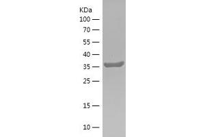 Western Blotting (WB) image for Protein-tyrosine Phosphatase 1C (PTPN6) (AA 5-163) protein (His-IF2DI Tag) (ABIN7124693) (SHP1 Protein (AA 5-163) (His-IF2DI Tag))