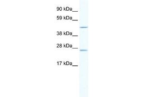 WB Suggested Anti-ANXA11 Antibody Titration:  2. (Annexin A11 Antikörper  (C-Term))
