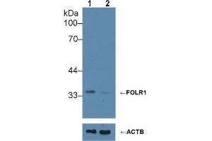 Knockout Varification: ;Lane 1: Wild-type Hela cell lysate; ;Lane 2: FOLR1 knockout Hela cell lysate; ;Predicted MW: 30kDa ;Observed MW: 35kDa;Primary Ab: 1µg/ml Rabbit Anti-Human FOLR1 Ab;Second Ab: 0.