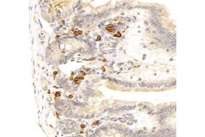 Immunohistochemistry analysis of paraffin-embedded mouse duodenum using,STC (ABIN7075723) at dilution of 1: 800 (Stanniocalcin 1 Antikörper)