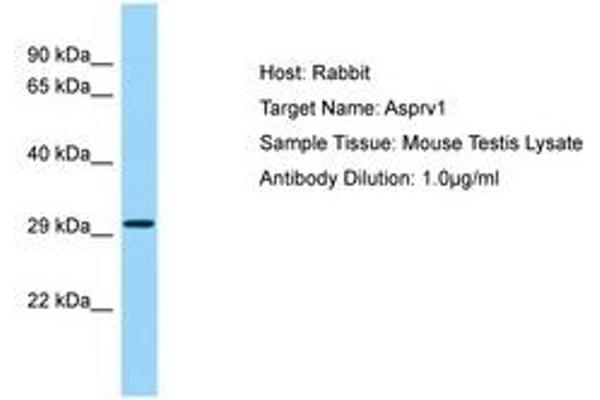 ASPRV1 Antikörper  (C-Term)