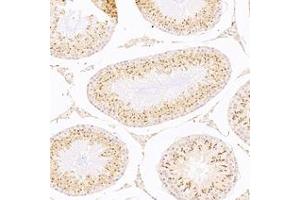 Immunohistochemistry analysis of paraffin-embedded rat testis using,ACRBP (ABIN7072890) at dilution of 1: 8000
