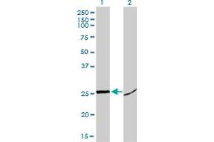 Western Blot analysis of HMGB1 expression in transfected 293T cell line by HMGB1 monoclonal antibody (M02), clone 1D5. (HMGB1 Antikörper  (AA 1-215))