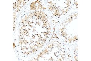anti-Inhibin, alpha (INHA) (AA 254-366) antibody