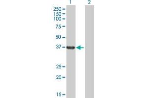 Western Blot analysis of RHOXF2 expression in transfected 293T cell line by RHOXF2 MaxPab polyclonal antibody. (RHOXF2 Antikörper  (AA 1-288))