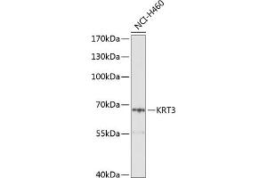 Western blot analysis of extracts of H460 cells, using KRT3 Antibody (ABIN6129539, ABIN6143027, ABIN6143028 and ABIN6214252) at 1:1000 dilution. (Keratin 3 Antikörper  (AA 230-390))