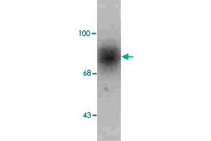 Western blot of human caudate lysate showing specific immunolabeling of the ~88k SLC6A3 protein. (SLC6A3 Antikörper  (C-Term))