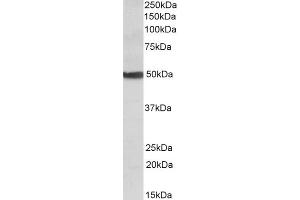 Western Blotting (WB) image for anti-Cytochrome P450, Family 24, Subfamily A, Polypeptide 1 (CYP24A1) (Internal Region) antibody (ABIN571265)