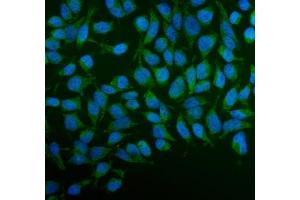 IF analysis of PFKFB2 using anti-PFKFB2 antibody (ABIN7601627). (PFKFB2 Antikörper  (AA 4-505))