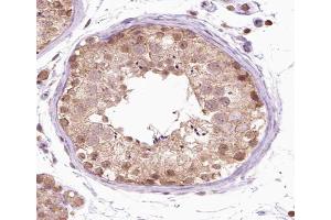 ABIN6266538 at 1/100 staining human testis tissue sections by IHC-P. (FGFR1OP Antikörper  (C-Term))
