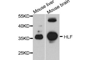 Western blot analysis of extract of mouse liver and mouse brain cells, using HLF antibody. (HLF Antikörper)