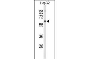 Western blot analysis of AFM Antibody in HepG2 cell line lysates (35ug/lane) (Afamin Antikörper  (N-Term))