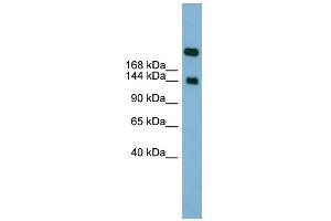 WB Suggested Anti-SI Antibody Titration:  0. (SI Antikörper  (Middle Region))