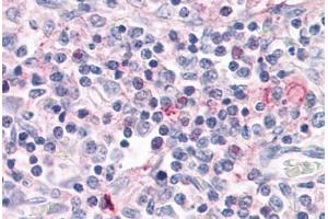 Anti-ROR Gamma antibody  ABIN1049302 IHC staining of human thymus. (RORC Antikörper  (Ligand Binding Domain))