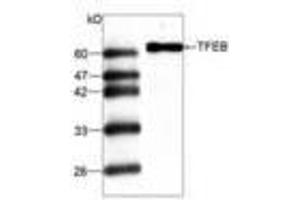 Image no. 1 for anti-Transcription Factor EB (TFEB) antibody (ABIN791477) (TFEB Antikörper)