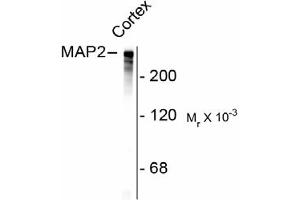 Image no. 1 for anti-Microtubule-Associated Protein 2 (MAP2) antibody (ABIN303924) (MAP2 Antikörper)